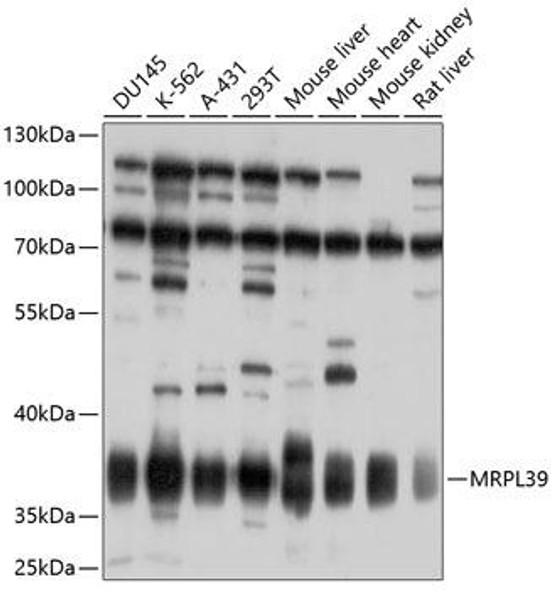 Cell Biology Antibodies 1 Anti-MRPL39 Antibody CAB10023