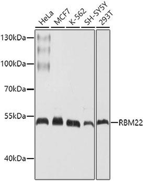 Epigenetics and Nuclear Signaling Antibodies 1 Anti-RBM22 Antibody CAB10025