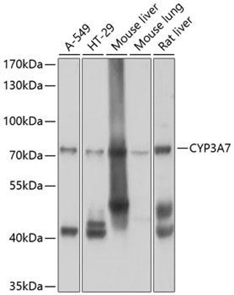 Metabolism Antibodies 1 Anti-CYP3A7 Antibody CAB10026