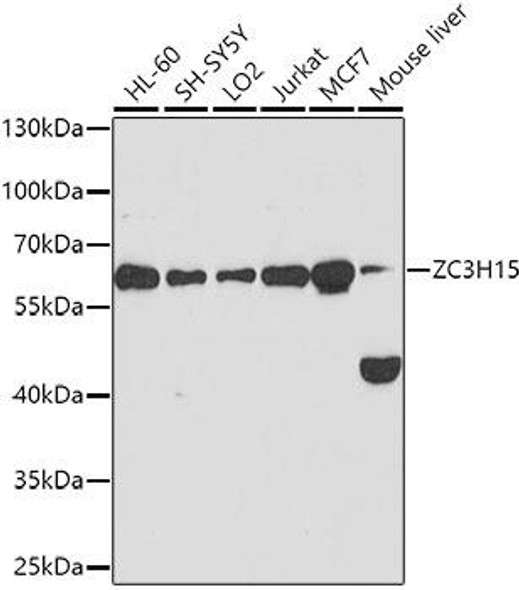 Cell Biology Antibodies 1 Anti-ZC3H15 Antibody CAB10045