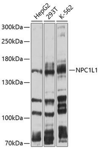 Metabolism Antibodies 1 Anti-NPC1L1 Antibody CAB10049