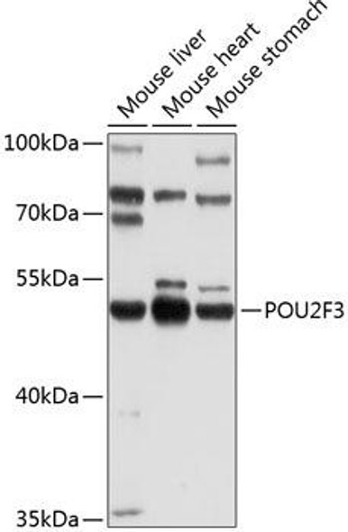 Epigenetics and Nuclear Signaling Antibodies 1 Anti-POU2F3 Antibody CAB10054