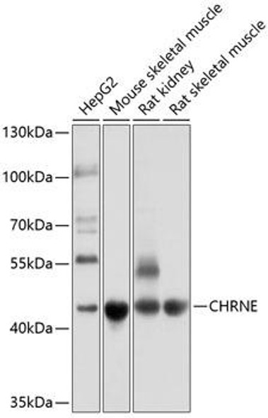 Signal Transduction Antibodies 1 Anti-CHRNE Antibody CAB10057