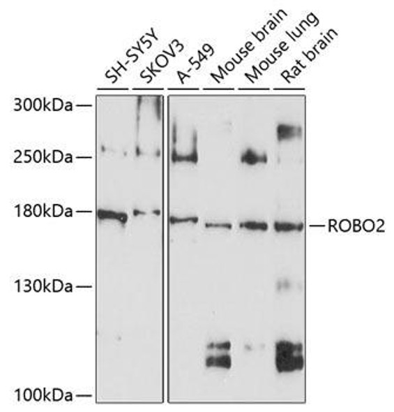 Cell Biology Antibodies 1 Anti-ROBO2 Antibody CAB10070