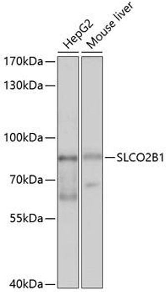 Signal Transduction Antibodies 1 Anti-SLCO2B1 Antibody CAB10073