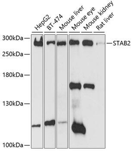 Cell Biology Antibodies 1 Anti-STAB2 Antibody CAB10074