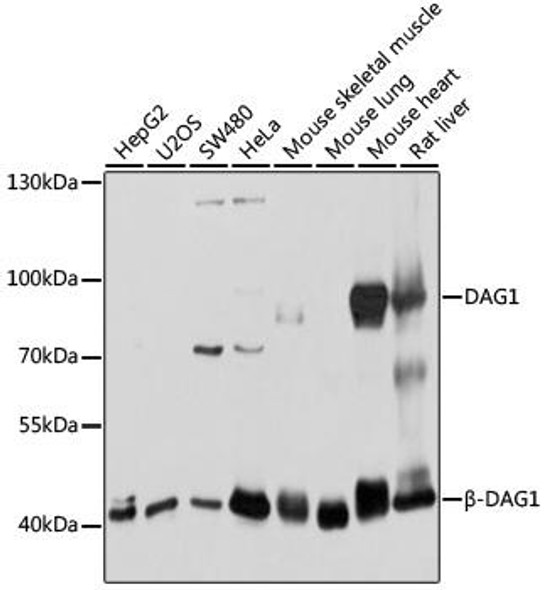 Immunology Antibodies 1 Anti-DAG1 Antibody CAB10076