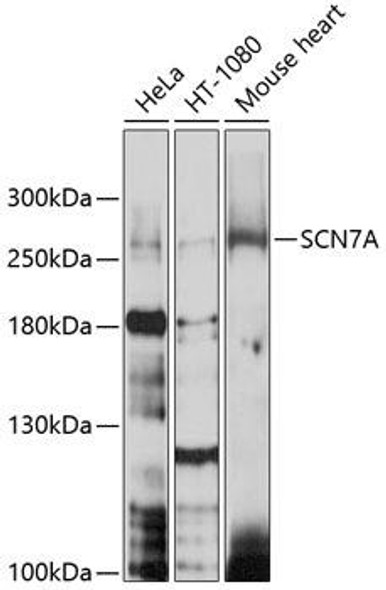 Signal Transduction Antibodies 1 Anti-SCN7A Antibody CAB10088