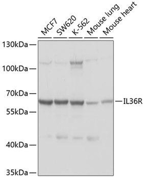 Immunology Antibodies 1 Anti-IL-36R Antibody CAB10090