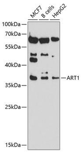 Cell Biology Antibodies 1 Anti-ART1 Antibody CAB10103