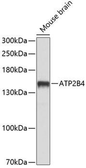 Cell Biology Antibodies 1 Anti-ATP2B4 Antibody CAB10105