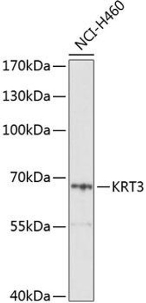 Cell Biology Antibodies 1 Anti-KRT3 Antibody CAB10118