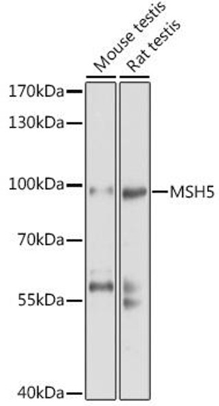 Epigenetics and Nuclear Signaling Antibodies 1 Anti-MSH5 Antibody CAB10121