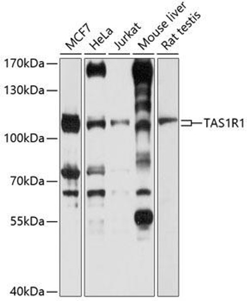 Signal Transduction Antibodies 1 Anti-TAS1R1 Antibody CAB10156