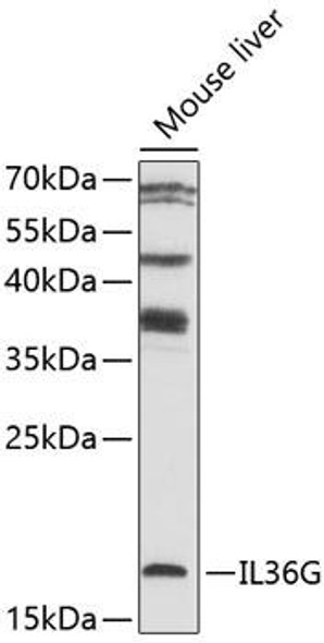 Cell Biology Antibodies 16 Anti-IL-36G Antibody CAB10165