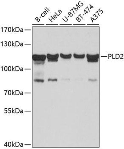 Metabolism Antibodies 1 Anti-PLD2 Antibody CAB10192