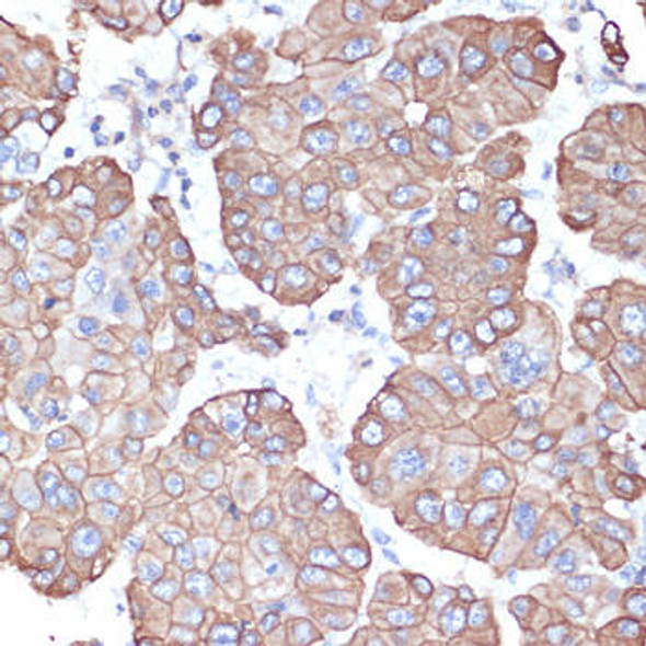 Cytokeratin 12 (KRT12) Antibody (CAB14746)