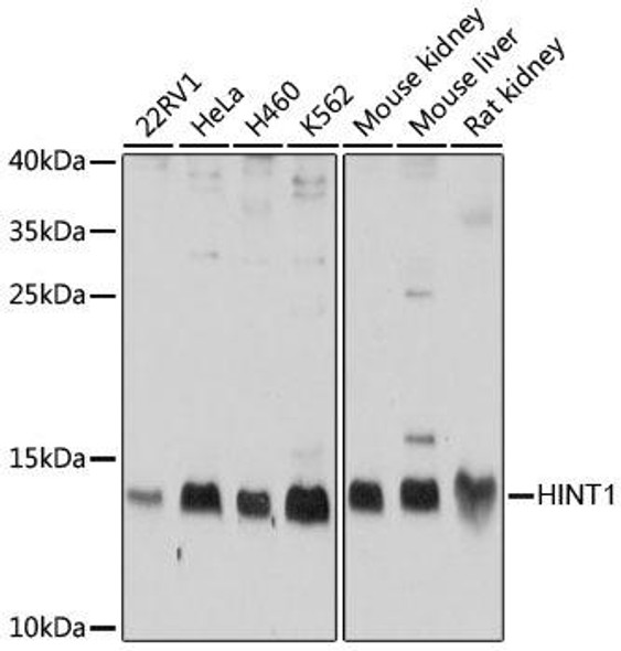 KO Validated Antibodies 1 Anti-HINT1 Antibody CAB10221KO Validated