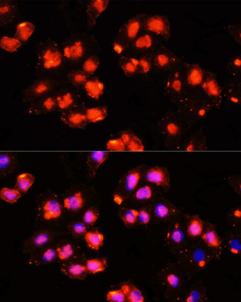 Epigenetics and Nuclear Signaling Antibodies 1 Anti-HOXB9 Antibody CAB10222