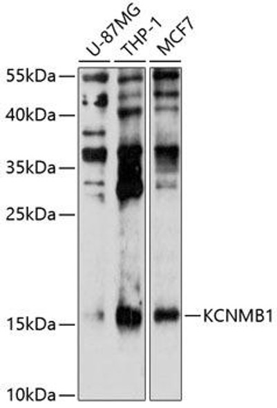 Signal Transduction Antibodies 1 Anti-KCNMB1 Antibody CAB10224
