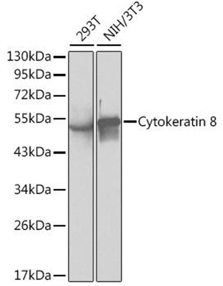 KO Validated Antibodies 1 Anti-Cytokeratin 8 Antibody CAB1024KO Validated