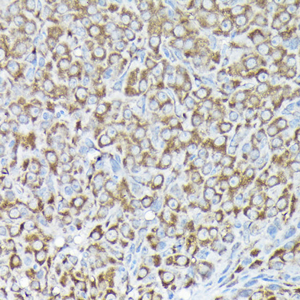 Cell Biology Antibodies 1 Anti-RPS15A Antibody CAB10241