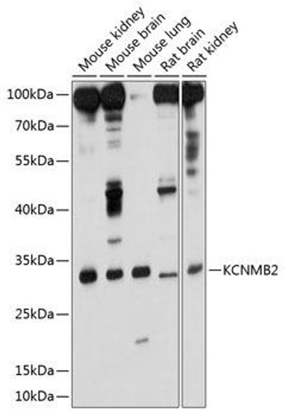 Signal Transduction Antibodies 1 Anti-KCNMB2 Antibody CAB10277