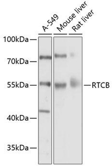 Epigenetics and Nuclear Signaling Antibodies 1 Anti-RTCB Antibody CAB10305