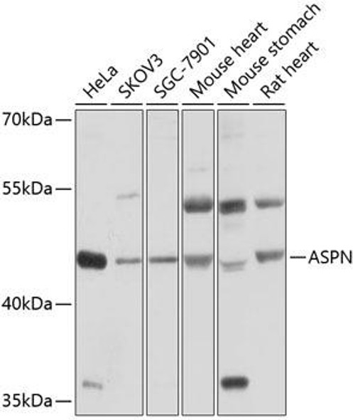 Signal Transduction Antibodies 1 Anti-ASPN Antibody CAB10311