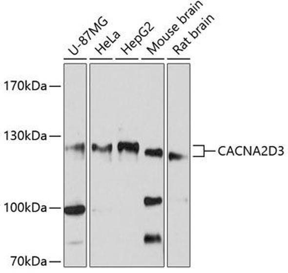Cell Biology Antibodies 1 Anti-CACNA2D3 Antibody CAB10315