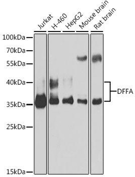 KO Validated Antibodies 1 Anti-DFFA Antibody CAB1032KO Validated