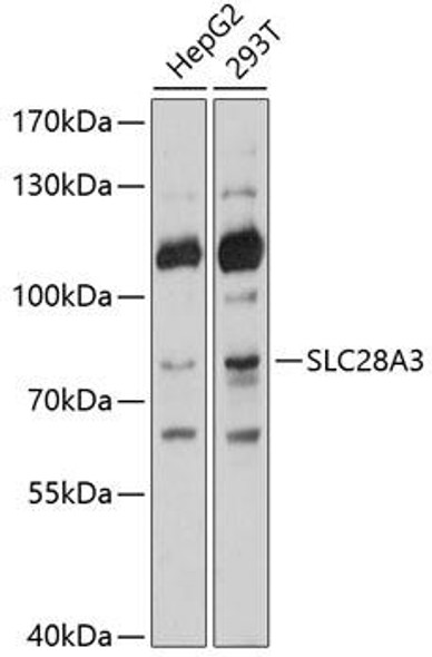 Cell Biology Antibodies 1 Anti-SLC28A3 Antibody CAB10320