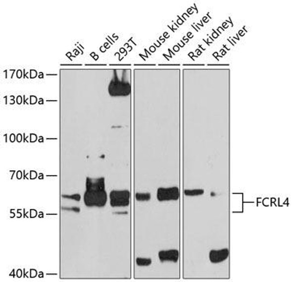 Immunology Antibodies 1 Anti-FCRL4 Antibody CAB10329