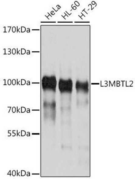 Epigenetics and Nuclear Signaling Antibodies 1 Anti-L3MBTL2 Antibody CAB10331