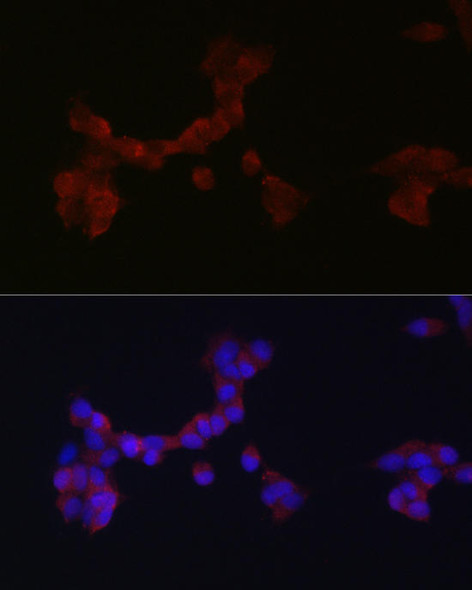 Developmental Biology Anti-DAB1 Antibody CAB10349