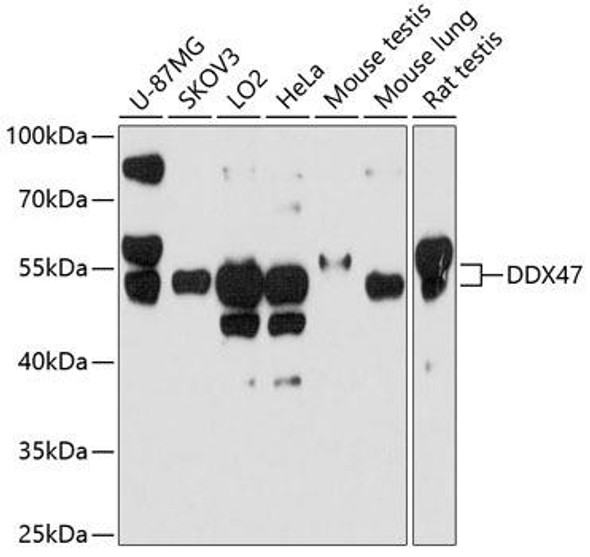 Cell Death Antibodies 1 Anti-DDX47 Antibody CAB10359