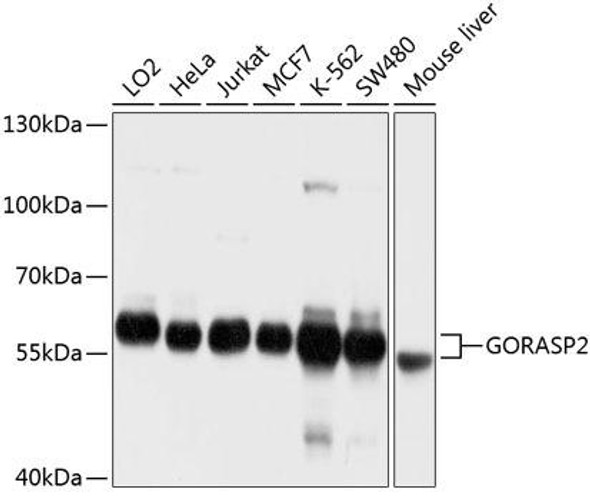 Developmental Biology Anti-GORASP2 Antibody CAB10383