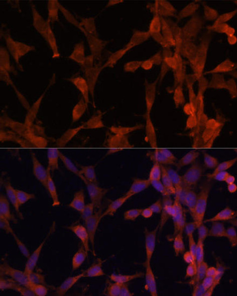 Signal Transduction Antibodies 1 Anti-UBE2G2 Antibody CAB10408