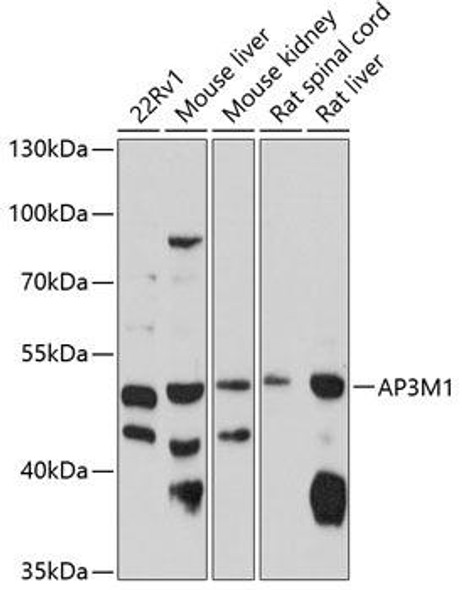 Immunology Antibodies 1 Anti-AP3M1 Antibody CAB10410