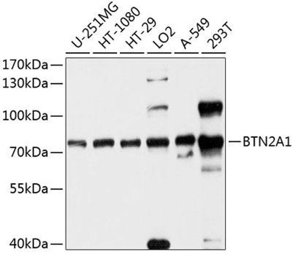 Cell Biology Antibodies 1 Anti-BTN2A1 Antibody CAB10418
