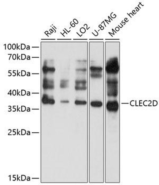 Cell Biology Antibodies 1 Anti-CLEC2D Antibody CAB10421