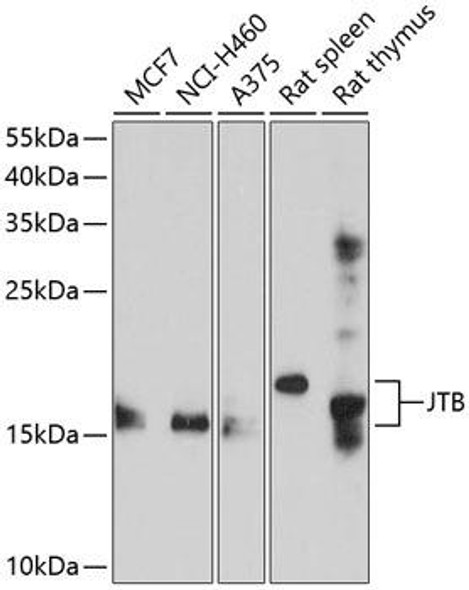 Cell Death Antibodies 1 Anti-JTB Antibody CAB10427