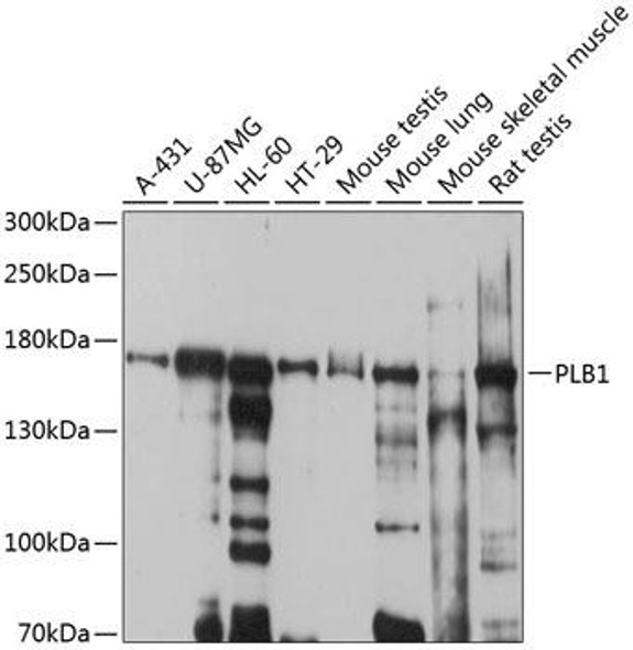 Metabolism Antibodies 1 Anti-PLB1 Antibody CAB10429