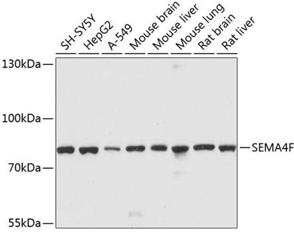 Developmental Biology Anti-SEMA4F Antibody CAB10432