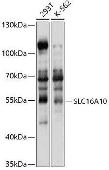 Signal Transduction Antibodies 1 Anti-SLC16A10 Antibody CAB10433