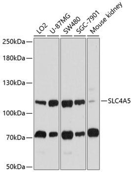 Signal Transduction Antibodies 1 Anti-SLC4A5 Antibody CAB10436