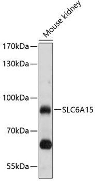 Signal Transduction Antibodies 1 Anti-SLC6A15 Antibody CAB10437