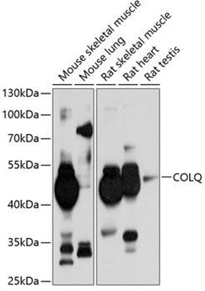 Neuroscience Anti-COLQ Antibody CAB10448