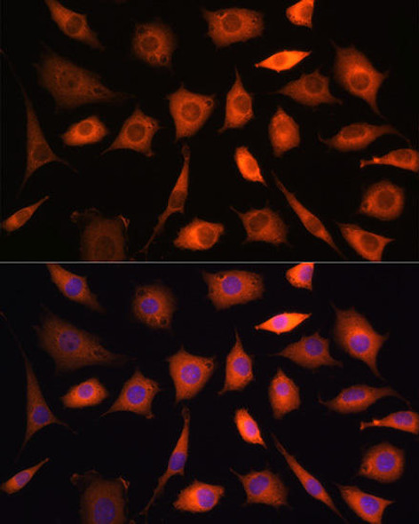 Metabolism Antibodies 1 Anti-PHGDH Antibody CAB10461