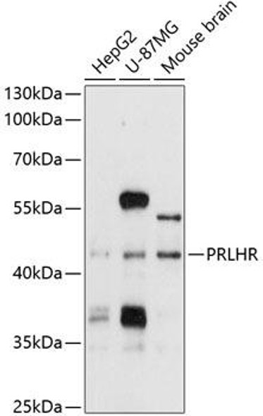 Cell Biology Antibodies 1 Anti-PRLHR Antibody CAB10479